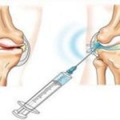 Как се инжектират хиалуронова киселина в коляното
