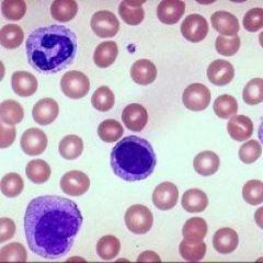 ماذا يظهر اختبار الدم العام: فك التشفير، القاعدة ماذا يعني ليم في اختبار الدم