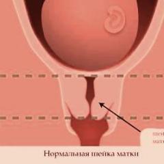Нормална дължина на шийката на матката по време на бременност Какво е това