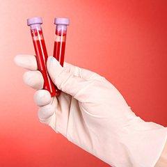 Какво трябва да бъде кръвен тест