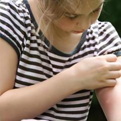 Как да лекуваме ухапвания от комари при дете, какви народни средства ще помогнат за лечение у дома?